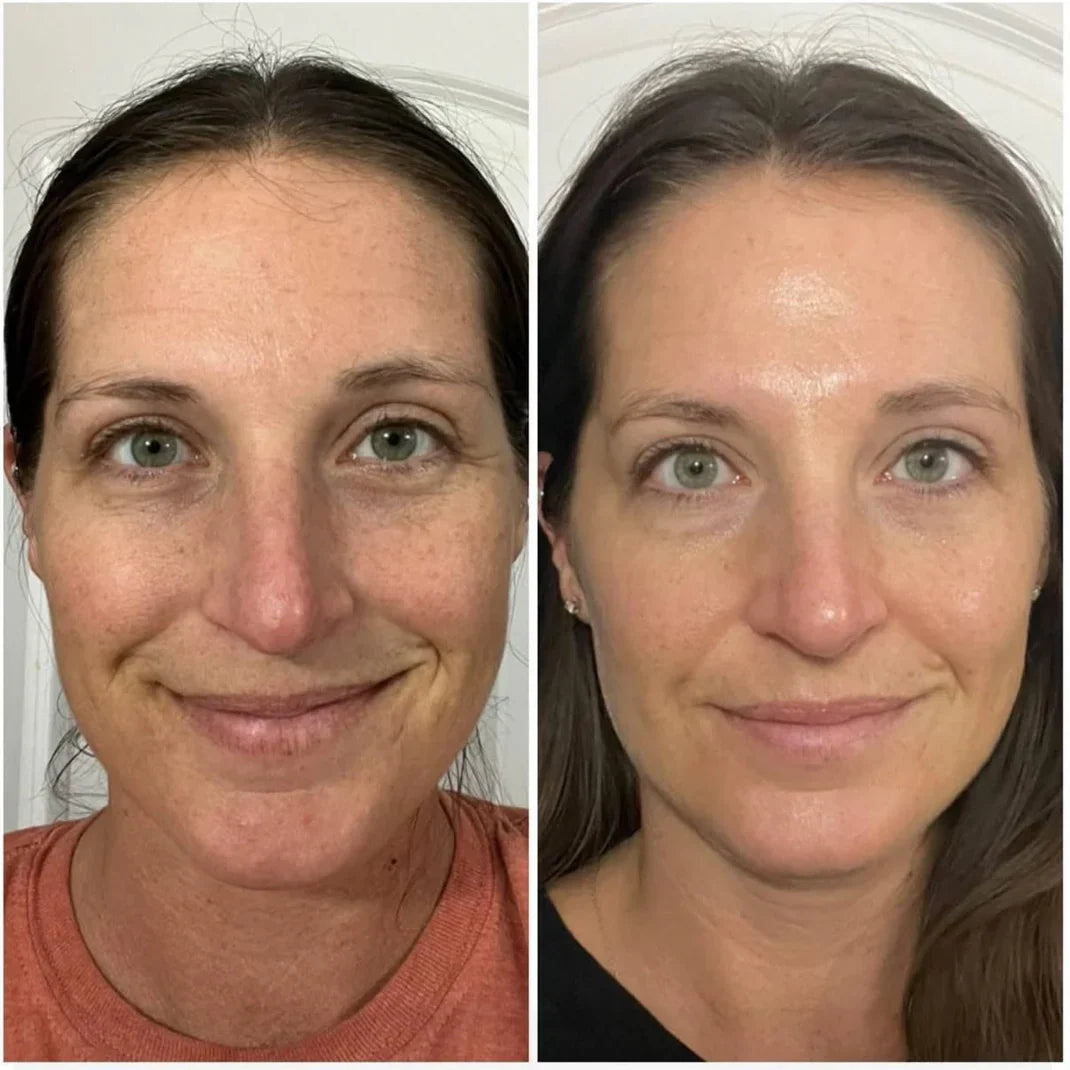 Wrinkle Bounce™ Multi-Balm – Instant Lift, Deep Hydration & Glow