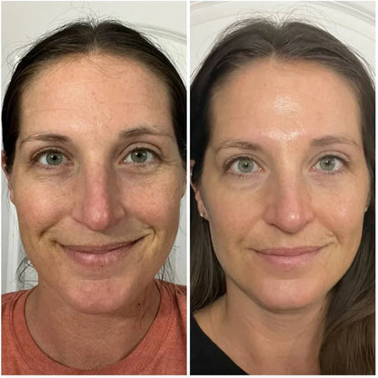 Wrinkle Bounce™ Multi-Balm – Instant Lift, Deep Hydration & Glow