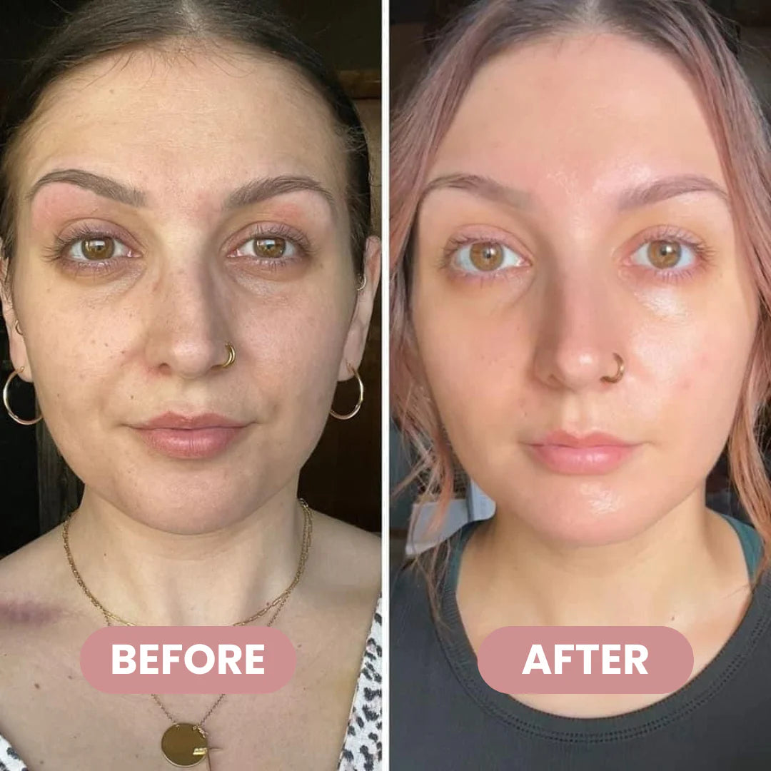 Wrinkle Bounce™ Multi-Balm – Instant Lift, Deep Hydration & Glow