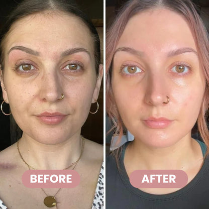 Wrinkle Bounce™ Multi-Balm – Instant Lift, Deep Hydration & Glow