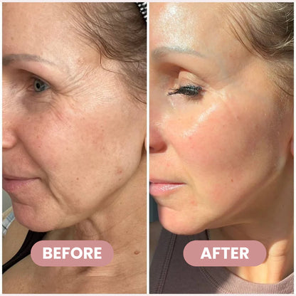 Wrinkle Bounce™ Multi-Balm – Instant Lift, Deep Hydration & Glow